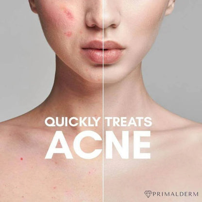Nuderma High Frequency Therapy | Clear Acne and Prevent Future Breakouts