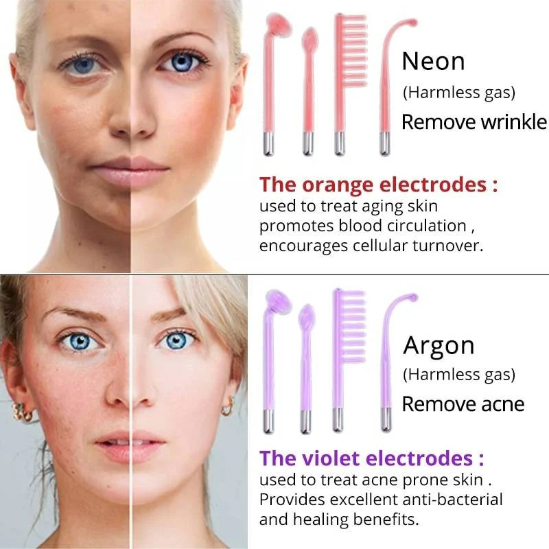 Nuderma High Frequency Therapy | Clear Acne and Prevent Future Breakouts