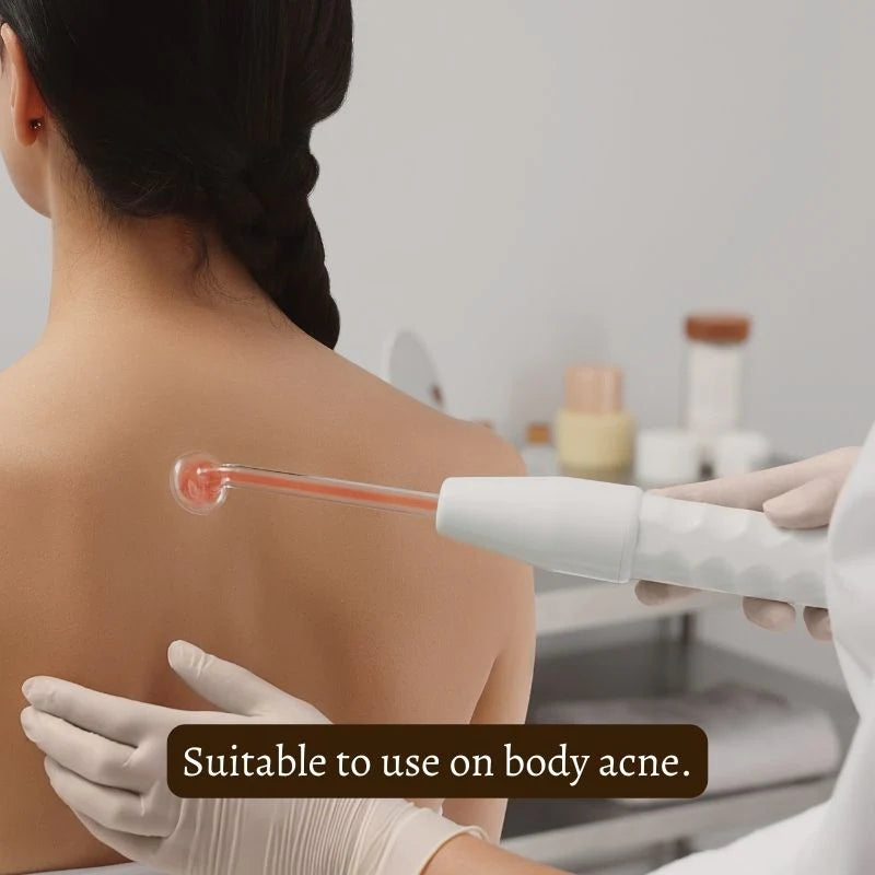 Nuderma High Frequency Therapy | Clear Acne and Prevent Future Breakouts